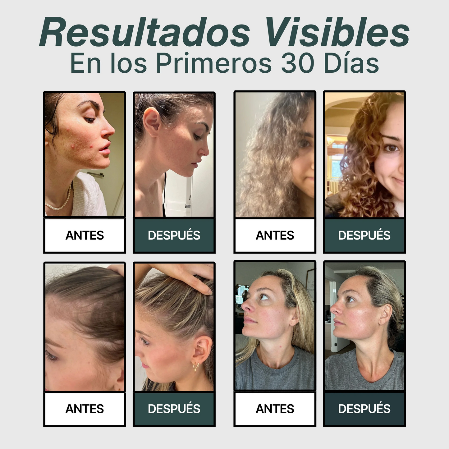 Salva Tu Piel, Tu Pelo y Tu Salud del Desastre con Orevis™